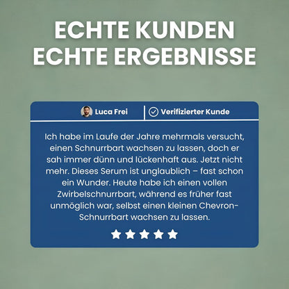 BeardPrime™ – Bartwuchsserum