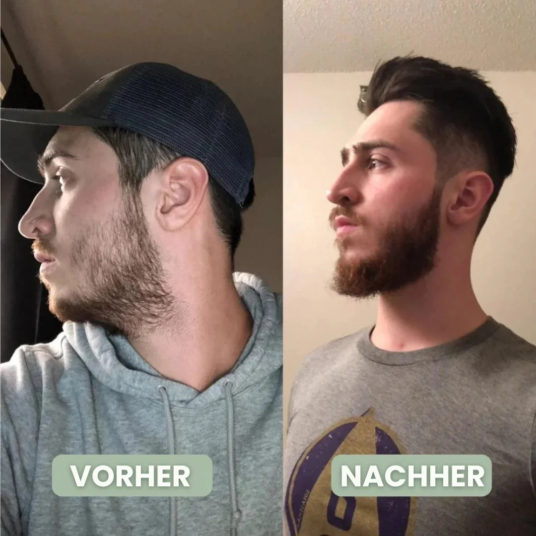 BeardPrime™ – Bartwuchsserum