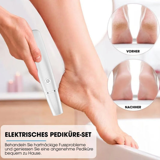 CalluCare™ – Elektrischer Hornhautentferner
